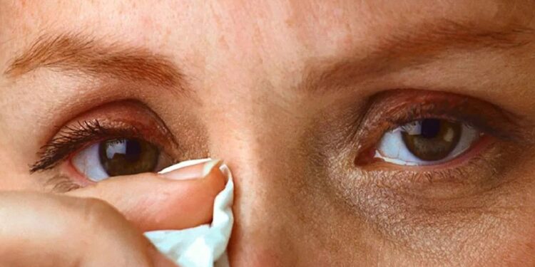 जळगाव जिल्ह्यात कंजक्टिव्हायटीस रूग्ण वाढले ; डोळ्यांची काळजी घेण्याचे आरोग्य विभागाचे आवाहन