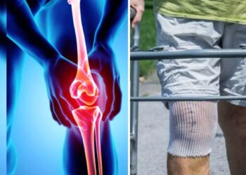 गुडघा अन् खुबा प्रत्यारोपण शस्त्रक्रिया होणार योजनेंतर्गत मोफत