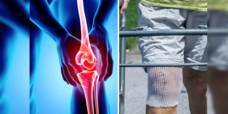 गुडघा अन् खुबा प्रत्यारोपण शस्त्रक्रिया होणार योजनेंतर्गत मोफत