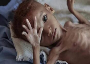 नंदुरबार जिल्ह्यात कुपोषित बालकांची संख्या वाढतीच; आताची आकडेवारी वाचा