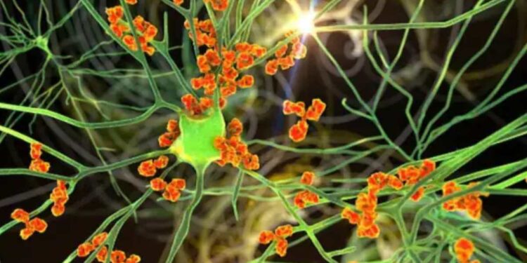 चिंता वाढली : पुण्यात जीबी सिंड्रोममुळे एकाच दिवशी दोघांचा मृत्यू, पालिका प्रशासन अलर्टवर