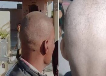 आता हे काय? बुलढाण्यात नव्या टक्कल व्हायरसचा प्रादुर्भाव: नागरिक भयभीत