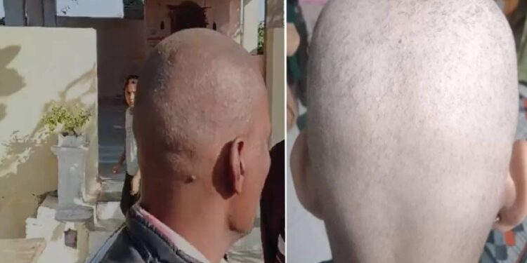 आता हे काय? बुलढाण्यात नव्या टक्कल व्हायरसचा प्रादुर्भाव: नागरिक भयभीत